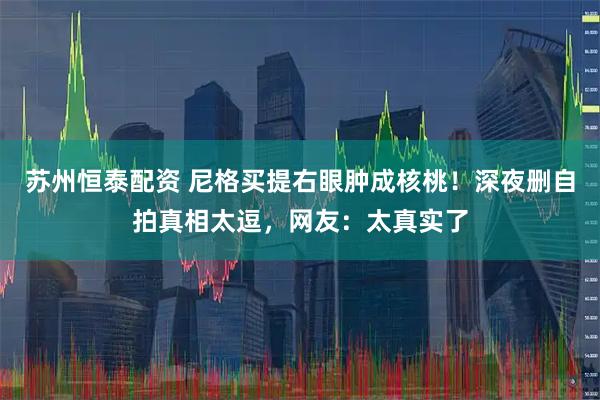 苏州恒泰配资 尼格买提右眼肿成核桃！深夜删自拍真相太逗，网友：太真实了